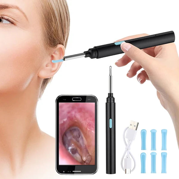 Intelligent Visual Earwax Device